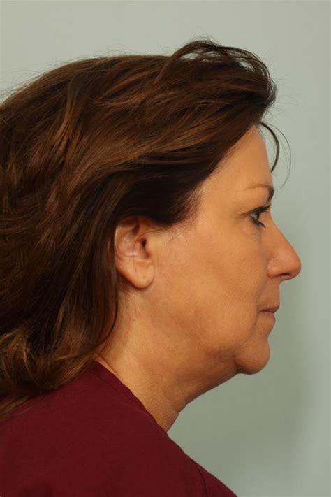 el paso cosmetic surgery|el paso cosmetic surgery prices.